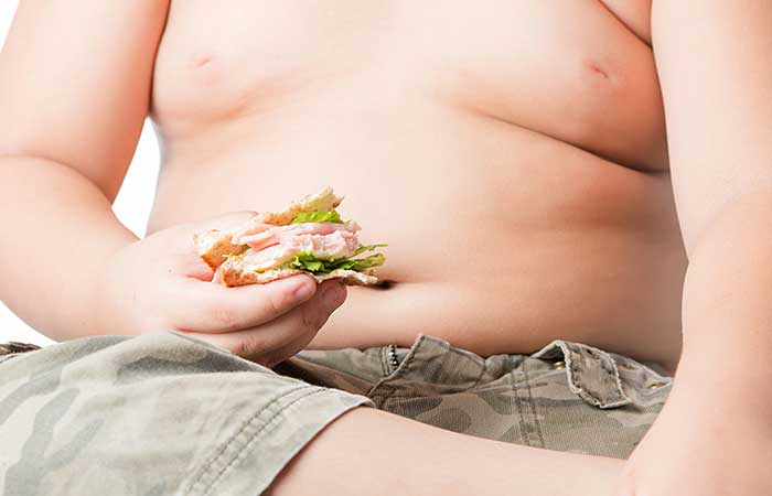 Nguyên nhân thúc đẩy béo phì